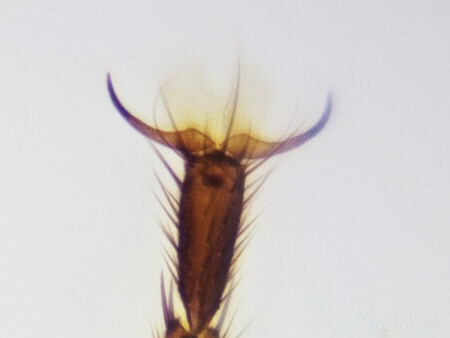 Noha muchy pod mikroskopom
